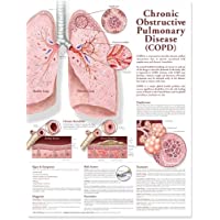 Los mejores  - Carta anatómica de la enfermedad pulmonar obstructiva crónica